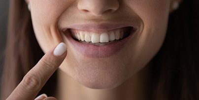 Лечение передних зубов